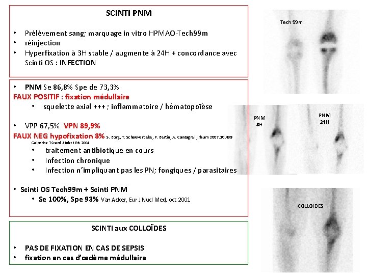 SCINTI PNM Tech 99 m • • • Prélèvement sang; marquage in vitro HPMAO-Tech