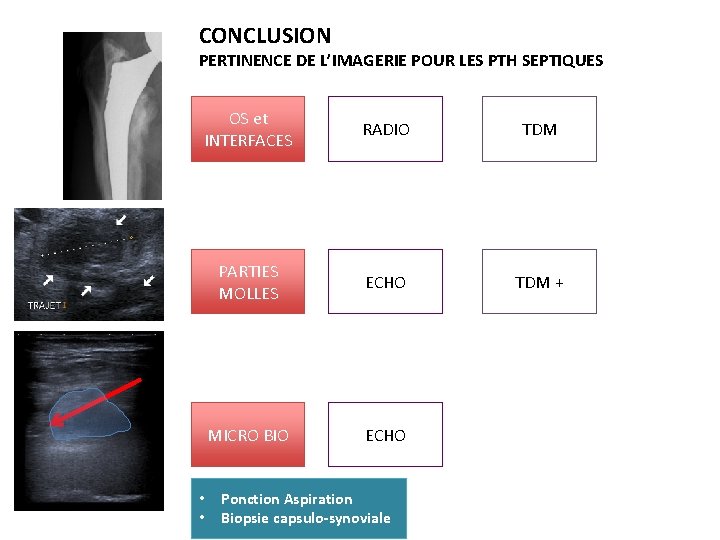 CONCLUSION PERTINENCE DE L’IMAGERIE POUR LES PTH SEPTIQUES OS et INTERFACES RADIO TDM PARTIES