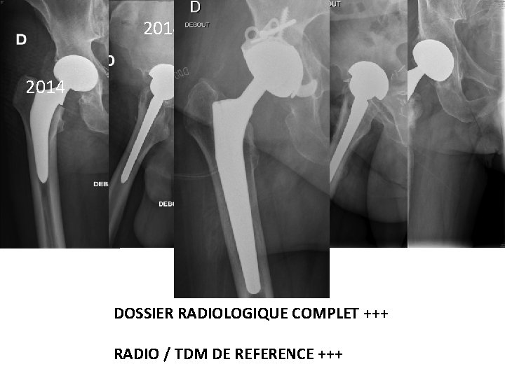 2014 DOSSIER RADIOLOGIQUE COMPLET +++ RADIO / TDM DE REFERENCE +++ 