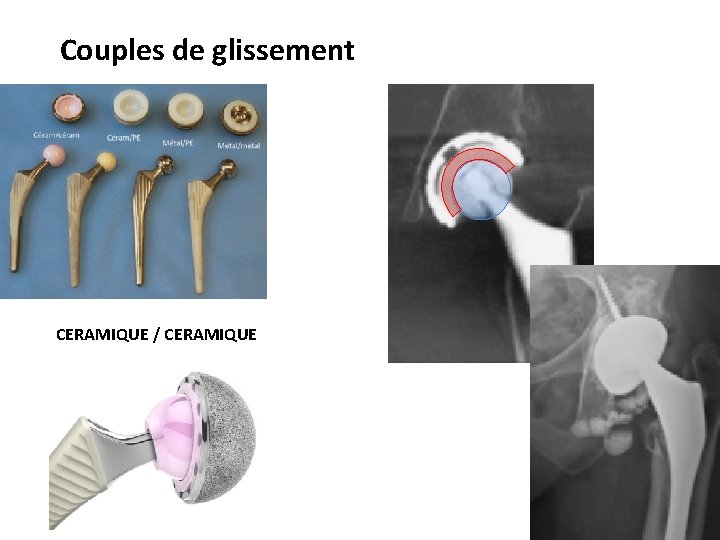 Couples de glissement CERAMIQUE / CERAMIQUE 