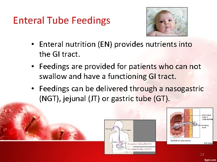 Enteral Tube Feedings • Enteral nutrition (EN) provides nutrients into the GI tract. •