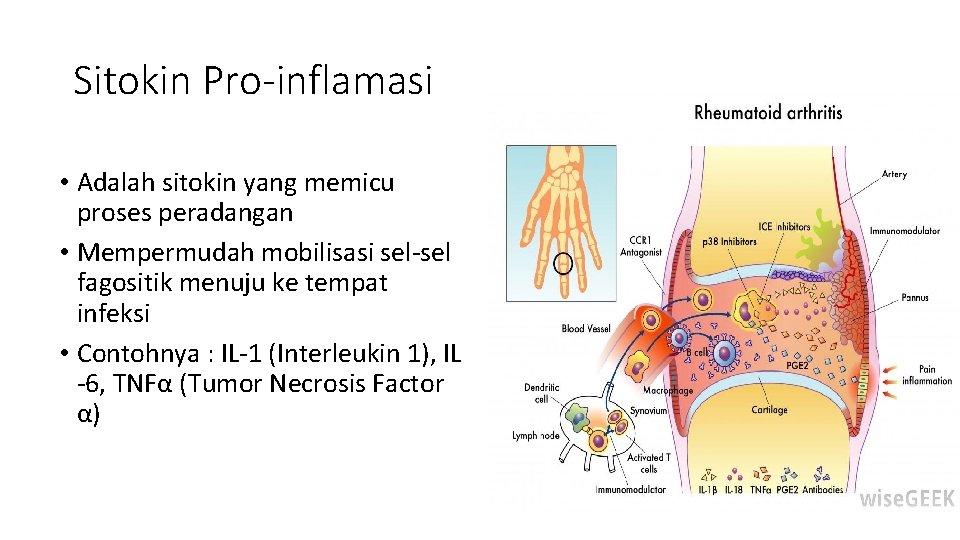 Sitokin Pro-inflamasi • Adalah sitokin yang memicu proses peradangan • Mempermudah mobilisasi sel-sel fagositik