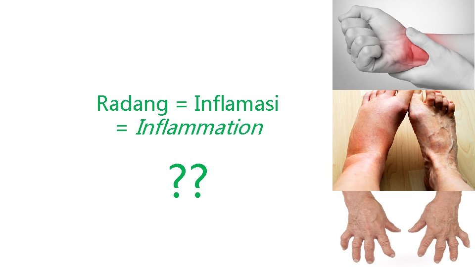 Radang = Inflamasi = Inflammation ? ? 