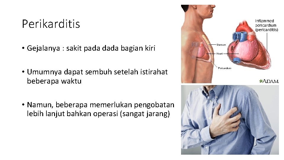 Perikarditis • Gejalanya : sakit pada dada bagian kiri • Umumnya dapat sembuh setelah