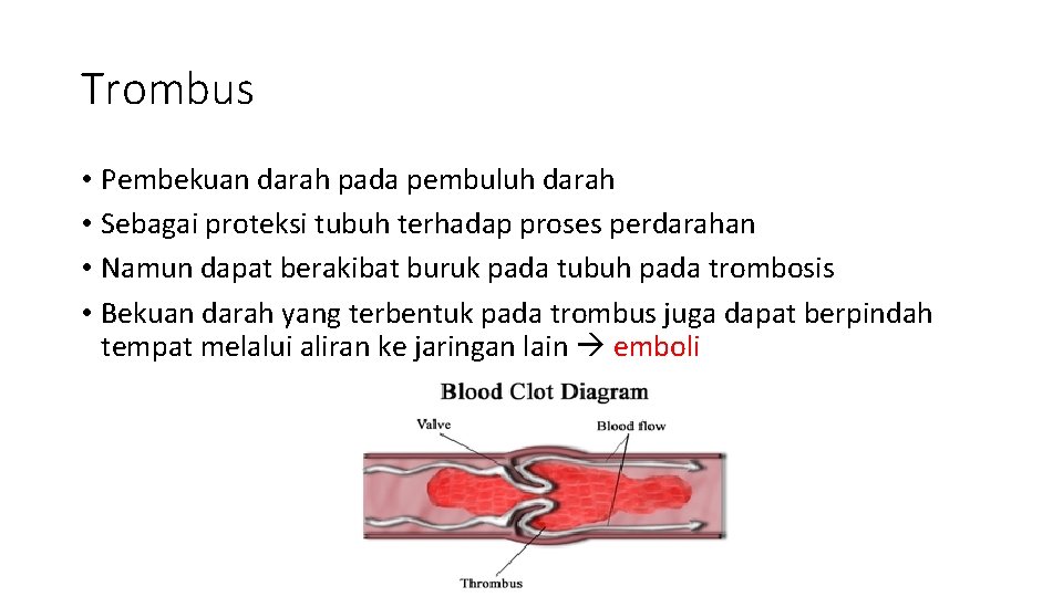 Trombus • Pembekuan darah pada pembuluh darah • Sebagai proteksi tubuh terhadap proses perdarahan