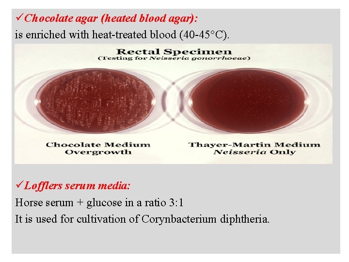 üChocolate agar (heated blood agar): is enriched with heat-treated blood (40 -45°C). üLofflers serum