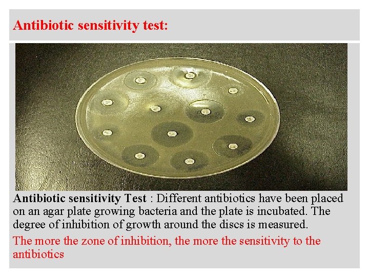 Antibiotic sensitivity test: Antibiotic sensitivity Test : Different antibiotics have been placed on an