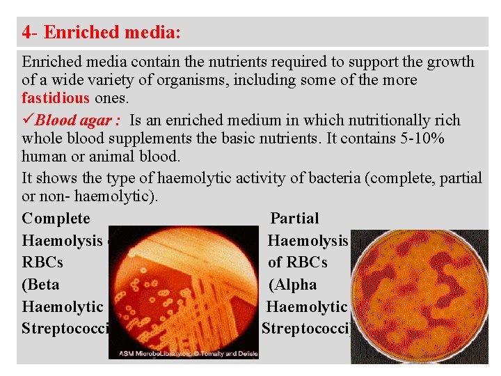 4 - Enriched media: Enriched media contain the nutrients required to support the growth