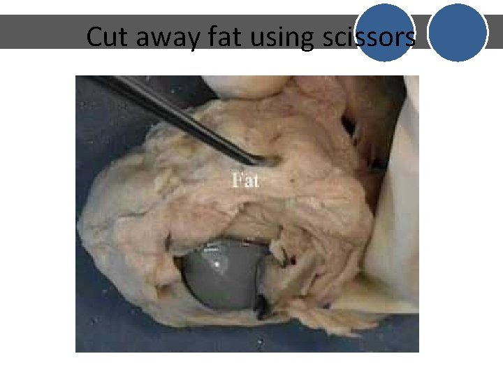 Cut away fat using scissors Cut away fat using scissors