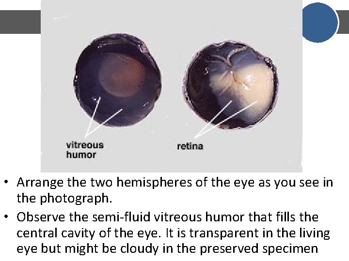 • Arrange the two hemispheres of the eye as you see in the • Arrange the two hemispheres of the eye as you see in the