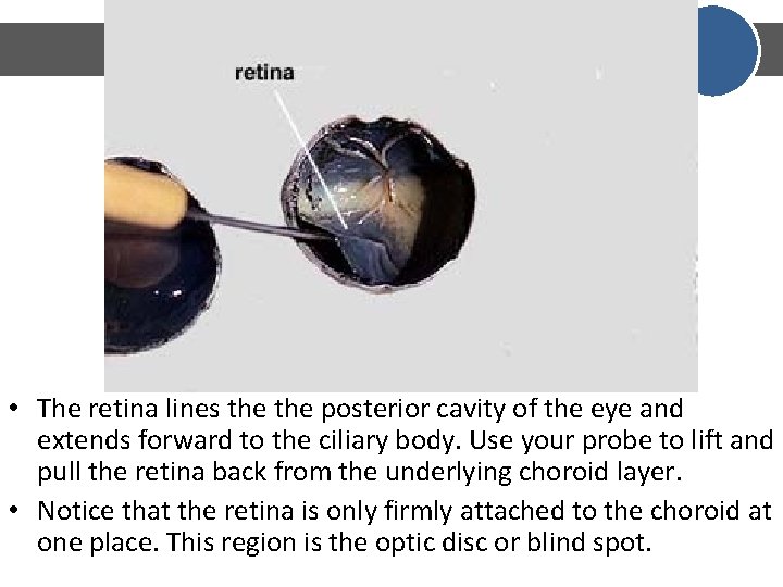 • The retina lines the posterior cavity of the eye and extends forward • The retina lines the posterior cavity of the eye and extends forward