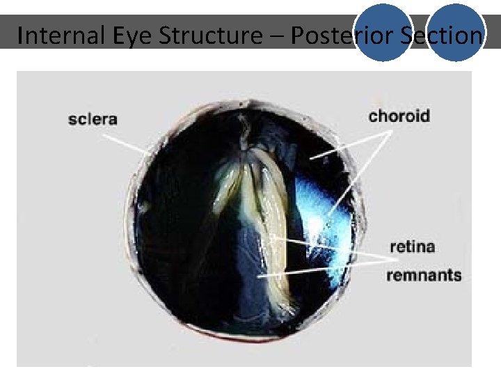 Internal Eye Structure – Posterior Section Internal Eye Structure – Posterior Section