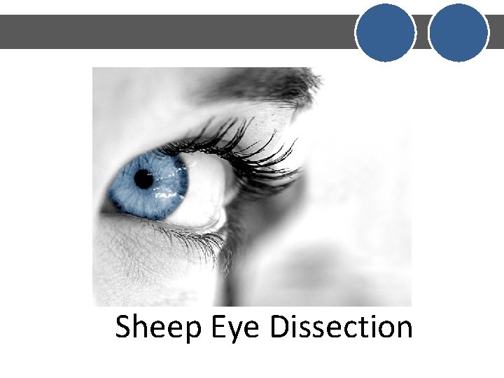 Sheep Eye Dissection Sheep Eye Dissection