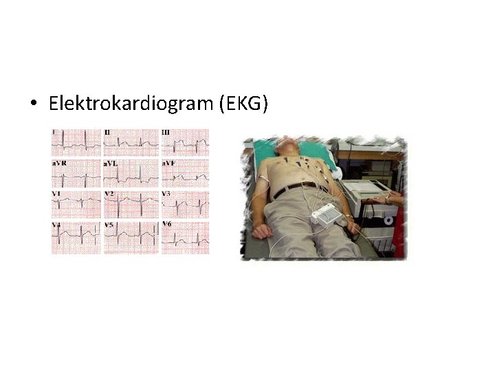 • Elektrokardiogram (EKG) • Elektrokardiogram (EKG)