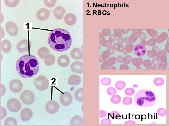 1. Neutrophils 2. RBCs 