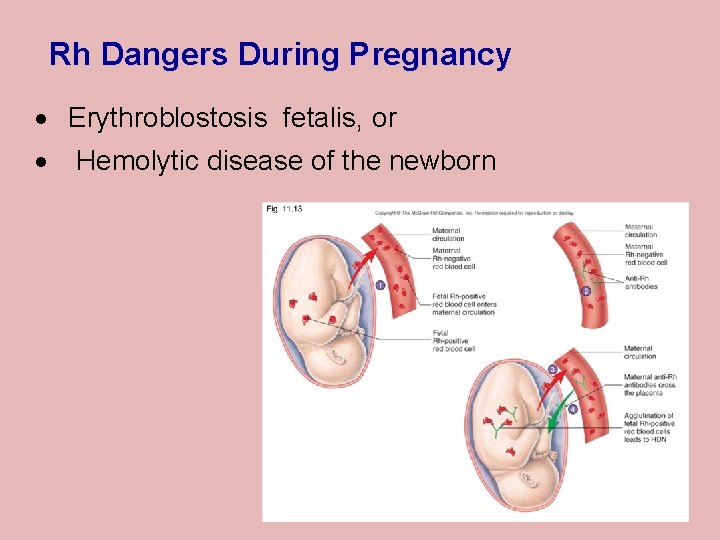Rh Dangers During Pregnancy · Erythroblostosis fetalis, or · Hemolytic disease of the newborn