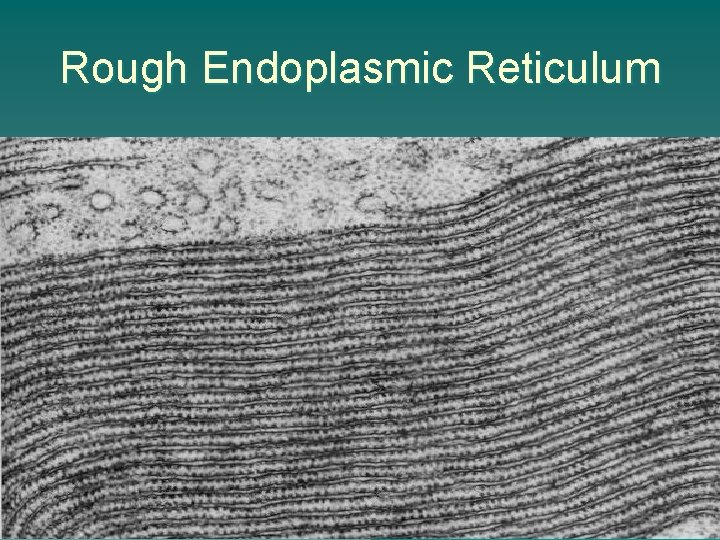 Rough Endoplasmic Reticulum 