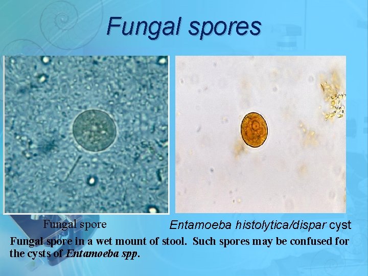 Fungal spores Fungal spore Entamoeba histolytica/dispar cyst Fungal spore in a wet mount of