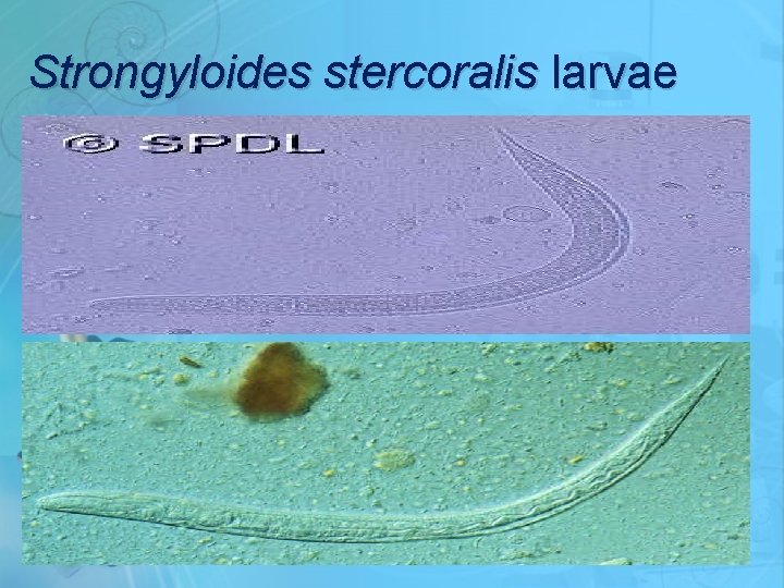 Strongyloides stercoralis larvae 