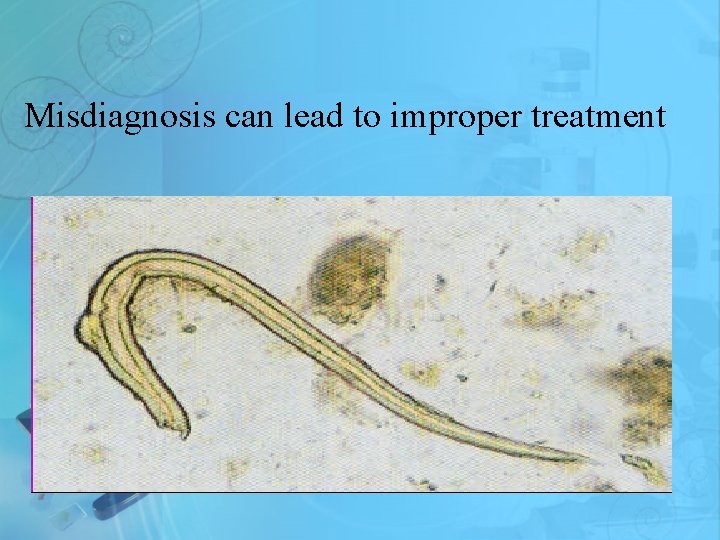 Misdiagnosis can lead to improper treatment 