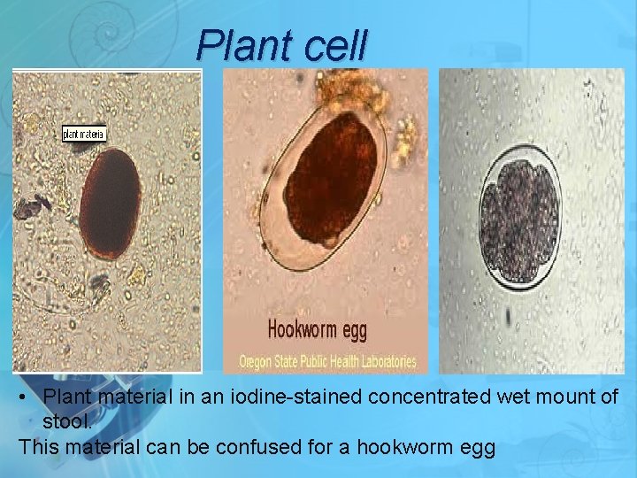 Plant cell • Plant material in an iodine-stained concentrated wet mount of stool. This