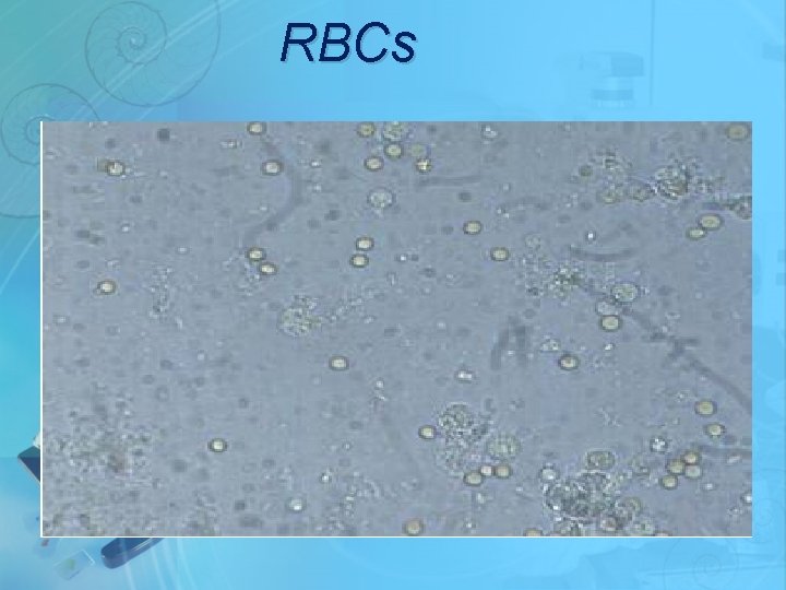 RBCs 