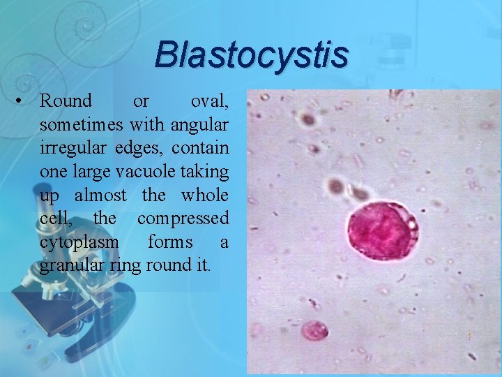 Blastocystis • Round or oval, sometimes with angular irregular edges, contain one large vacuole