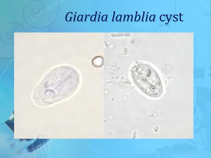 Giardia lamblia cyst 
