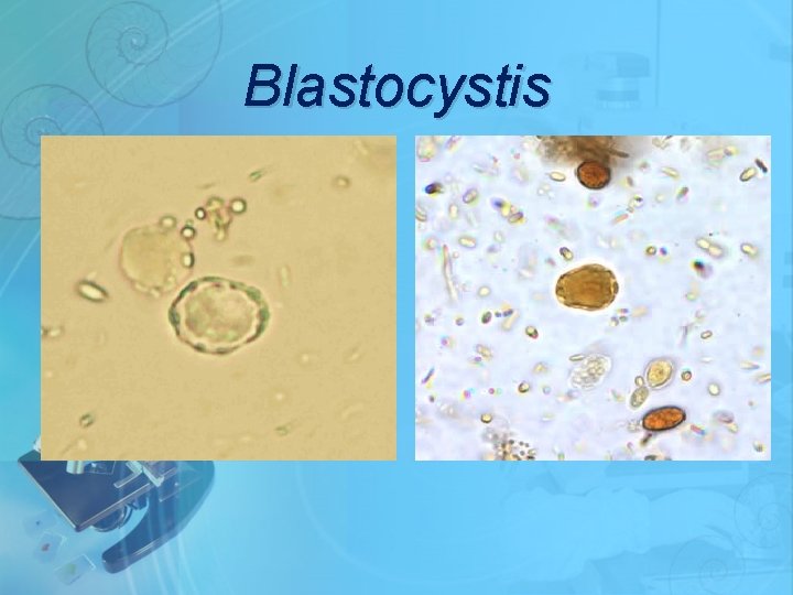 Blastocystis 