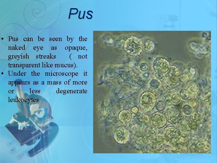 Pus • Pus can be seen by the naked eye as opaque, greyish streaks