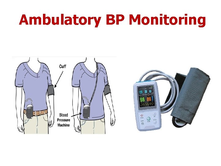 Ambulatory BP Monitoring 