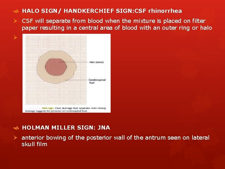 HALO SIGN/ HANDKERCHIEF SIGN: CSF rhinorrhea Ø CSF will separate from blood when HALO SIGN/ HANDKERCHIEF SIGN: CSF rhinorrhea Ø CSF will separate from blood when