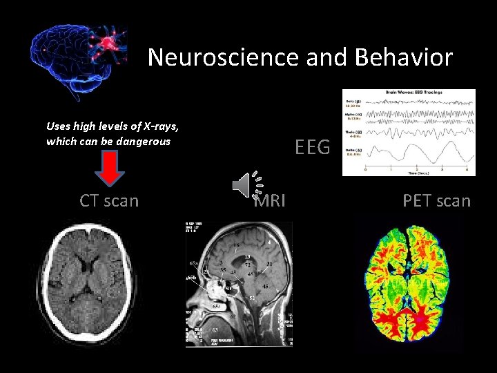 Neuroscience and Behavior Uses high levels of X-rays, which can be dangerous CT scan