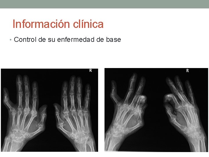 Información clínica • Control de su enfermedad de base 