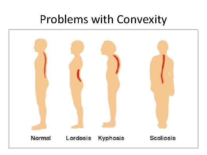 Problems with Convexity 