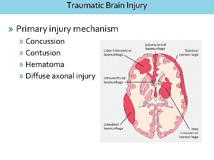 Traumatic Brain Injury » Primary injury mechanism » Concussion » Contusion » Hematoma »