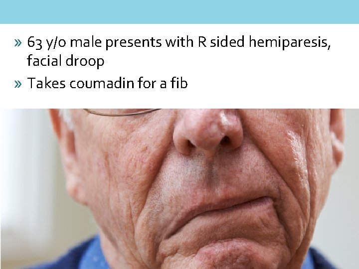 » 63 y/o male presents with R sided hemiparesis, facial droop » Takes coumadin