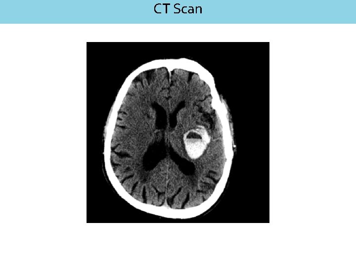 CT Scan 