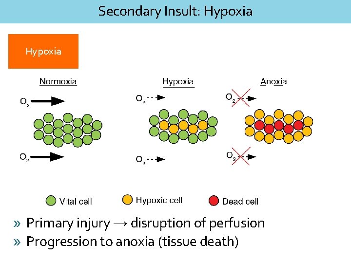 Secondary Insult: Hypoxia » Primary injury → disruption of perfusion » Progression to anoxia