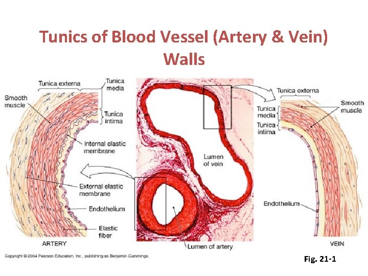 Tunics of Blood Vessel (Artery & Vein) Walls Fig. 21 -1 