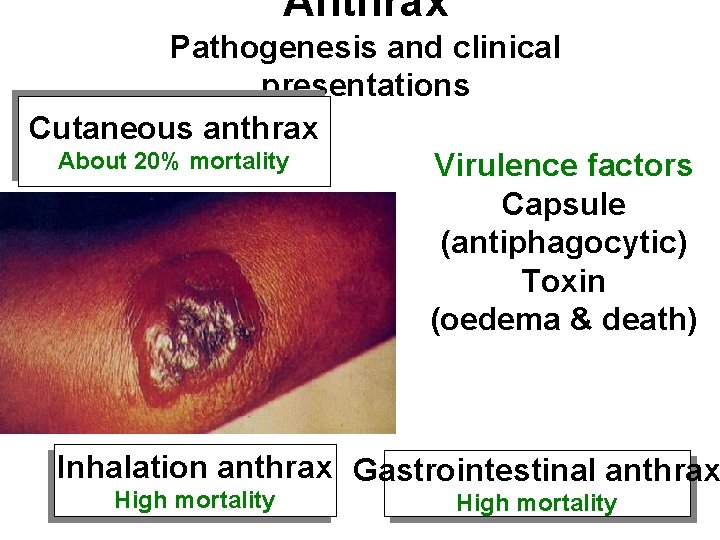 Anthrax Pathogenesis and clinical presentations Cutaneous anthrax About 20% mortality Virulence factors Capsule (antiphagocytic)