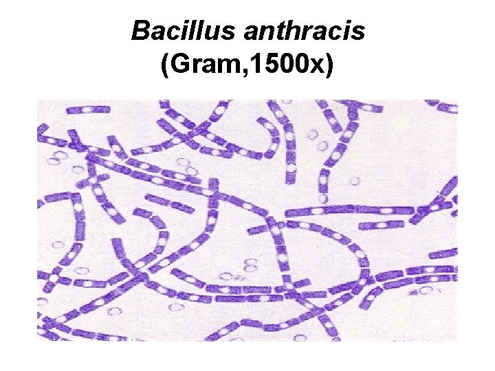 Bacillus anthracis (Gram, 1500 x) 