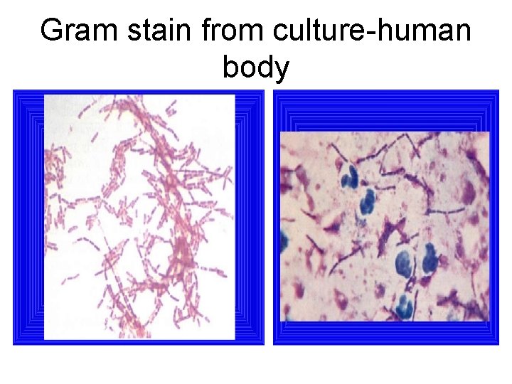 Gram stain from culture-human body 