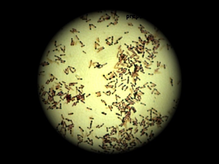 Corynebacterium diphtheriae preparat po Lubinskom 