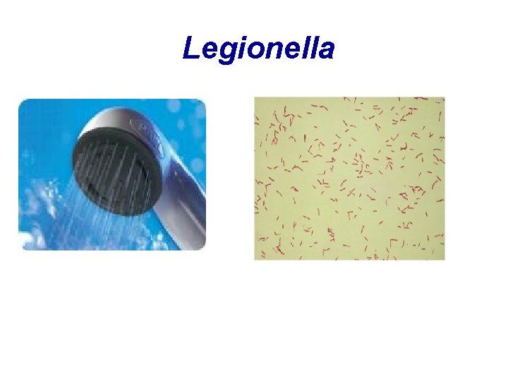 Legionella 