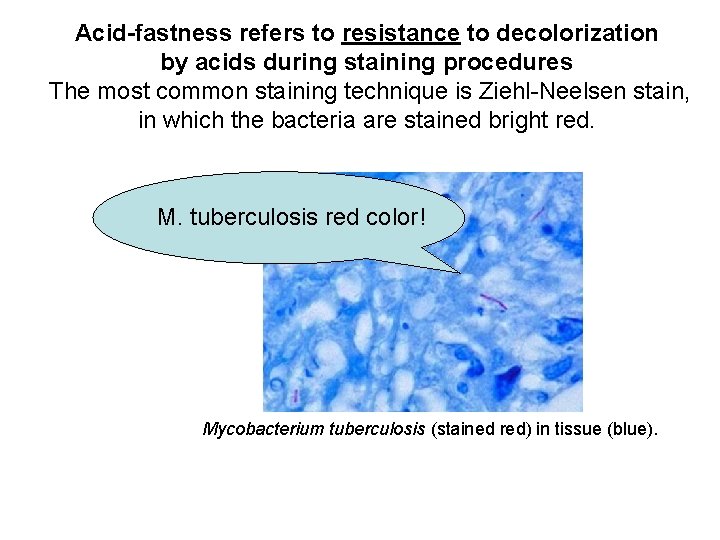 Acid-fastness refers to resistance to decolorization by acids during staining procedures The most common