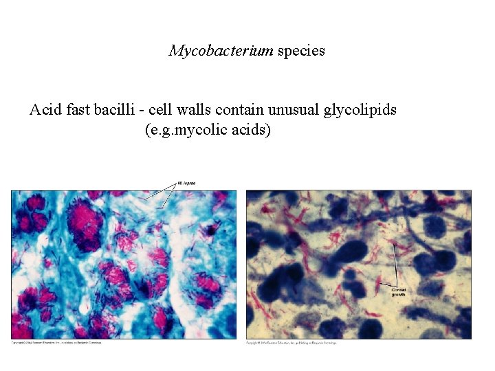 Mycobacterium species Acid fast bacilli - cell walls contain unusual glycolipids (e. g. mycolic