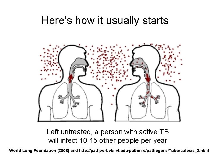 Here’s how it usually starts Left untreated, a person with active TB will infect