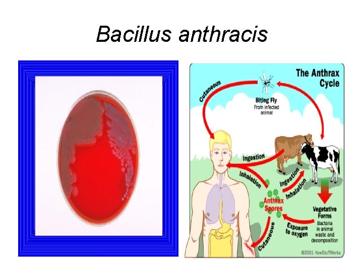 Bacillus anthracis 