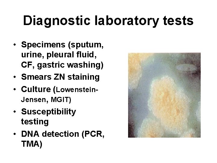 Diagnostic laboratory tests • Specimens (sputum, urine, pleural fluid, CF, gastric washing) • Smears